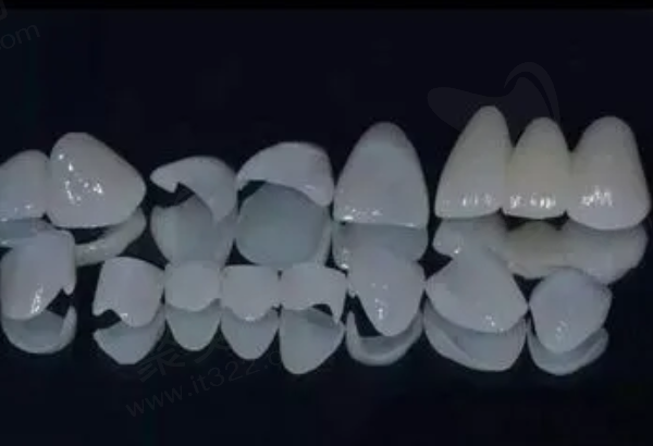 全瓷牙取下重新安装的注意事项