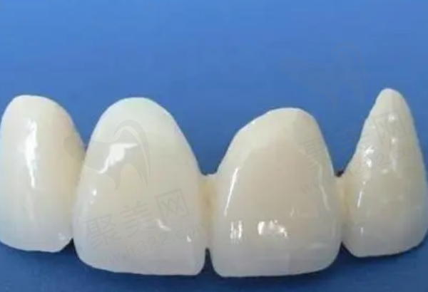 泽康全瓷牙的优点是什么