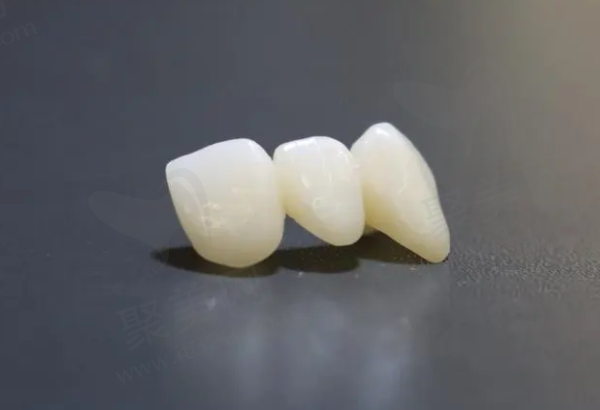 泽康全瓷牙的缺点有哪些
