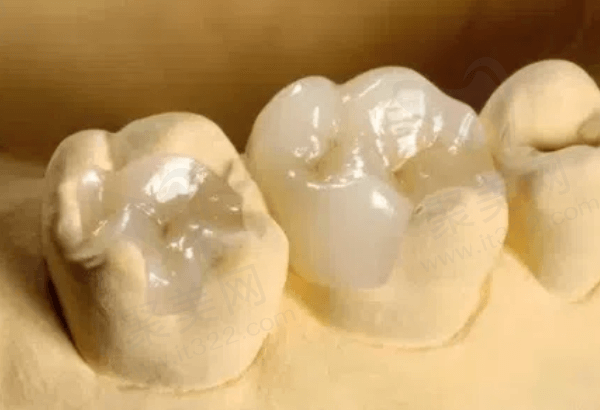 嵌体补牙和树脂补牙的区别是什么