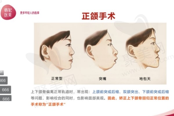 王涛医生做正颌手术怎么样