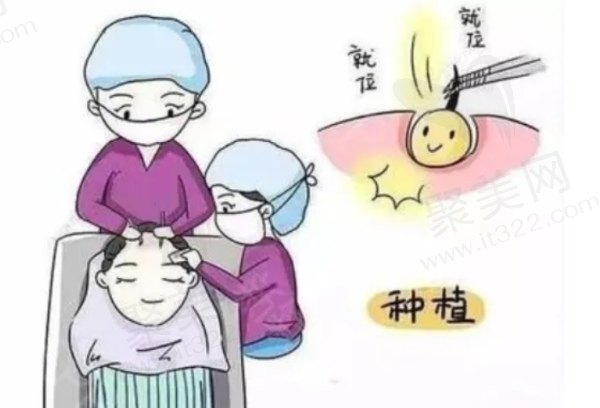 西安碧莲盛植发