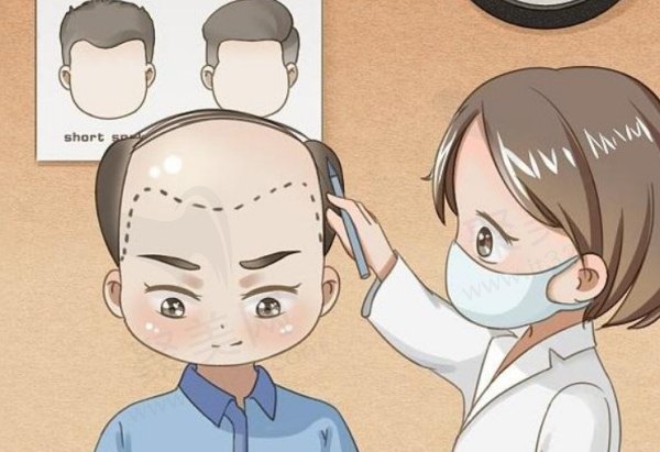 西安雍禾植发