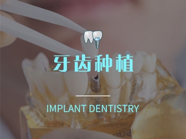 上海雅悦齿科种植牙价格表