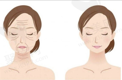 上海美莱候怡医生口碑怎么样？