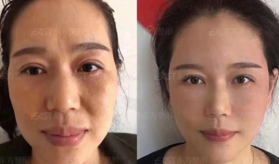 郑州东方整形医院贺焕焕医生