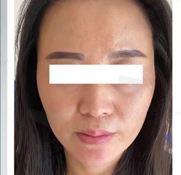 广州广大蒙石南做拉皮怎么样
