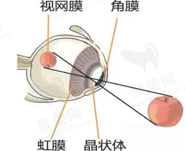 晶体脱位有什么症状？