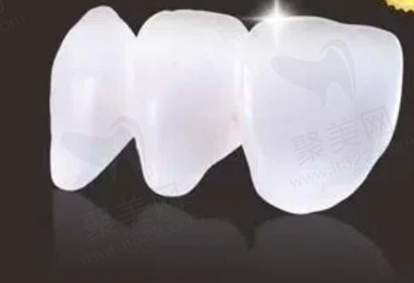 格莱美全瓷牙是进口还是国产