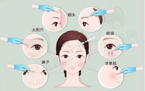薇旖美适用人群