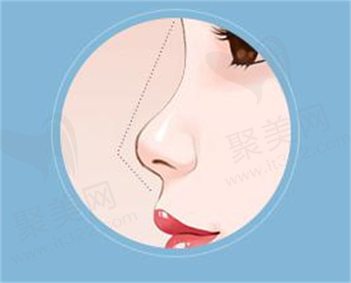 南京美莱做鼻子怎么样?
