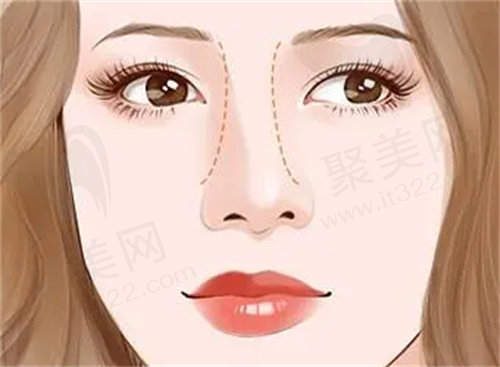 南京美莱郭心怡做鼻子怎么样？