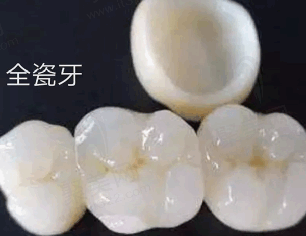广州曙光口腔医院全瓷牙怎么样