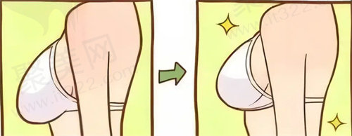 成都艺星隆胸怎么样?