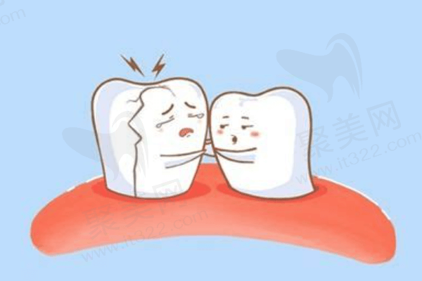 镶牙和补牙哪个牢固一点？