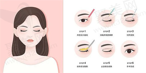 宁波艺星肖庆华怎么样?