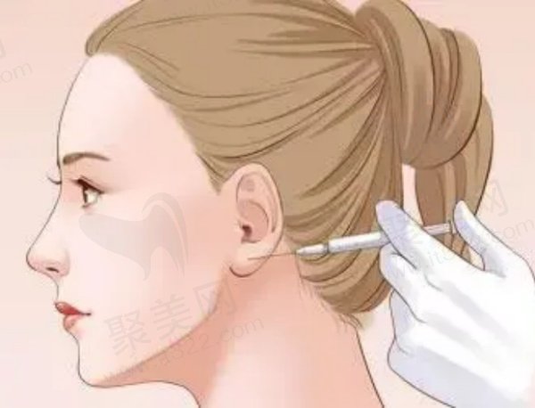 上海华美打咬肌口碑好 上海华美打咬肌口碑好