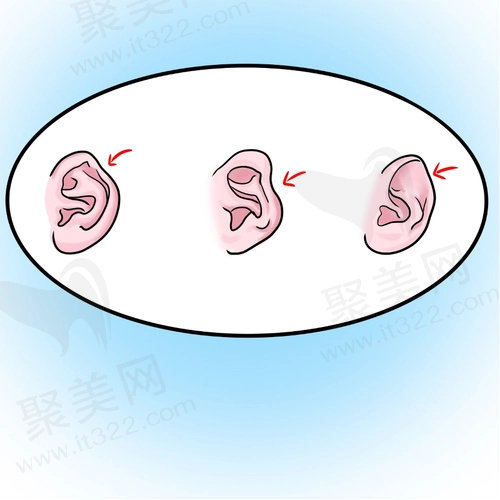 北京耳再造哪家医院好?