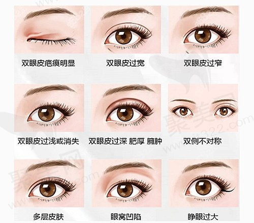 上海薇琳杨荣华医生RE-超IN妆感综合美眸价格
