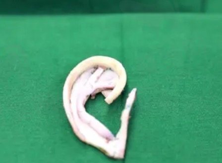 如何预约成都八大处耳再造手术？