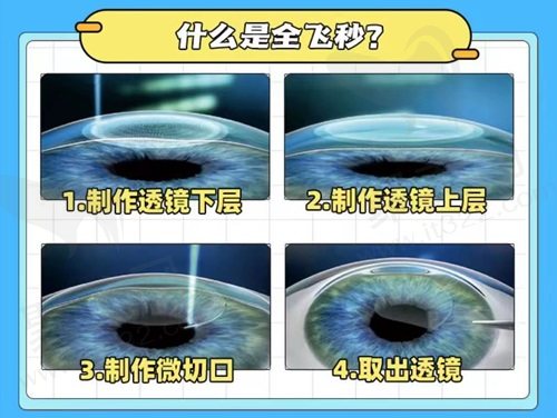 大连爱尔眼科医院谭永和做近视手术怎么样？