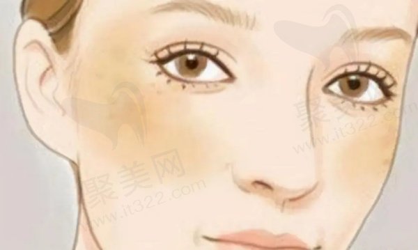 超脉冲点阵王修复疤痕怎么样 超脉冲点阵王修复疤痕怎么样