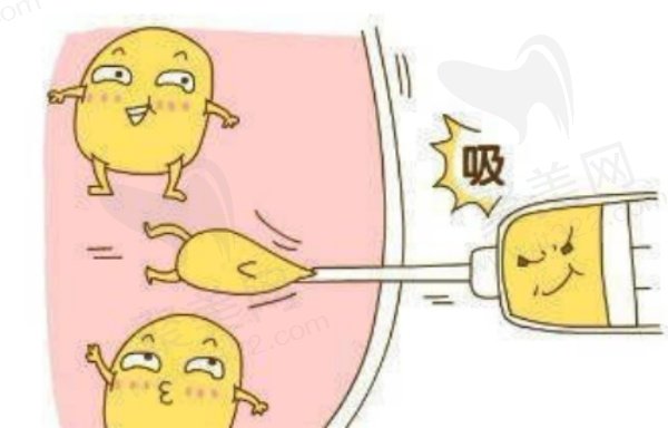 土麦森吸脂富贵包价格是多少