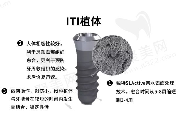 瑞士sic种植体和iTi哪个好