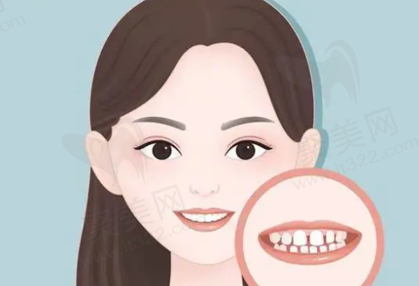 商丘看牙价格贵不贵