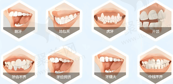 杭州美奥口腔牙齿矫正怎么样
