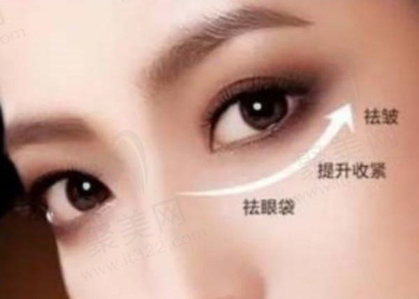 北京嘉禾医疗美容医院孙景波去眼袋技术特点