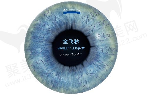 银川明慈眼科医院近视手术医生