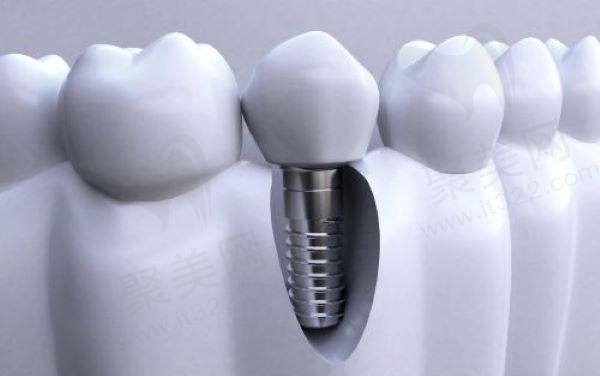 柳州看口腔能用医疗保险的定点医院