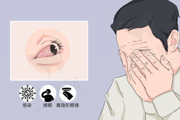 眼睛发炎红肿瘙痒怎么办