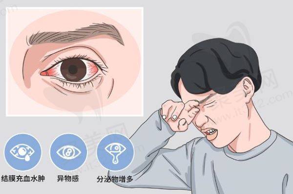 眼睛发炎红肿瘙痒是什么引起的