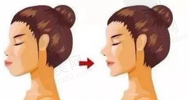 广州周会喜实例多吗