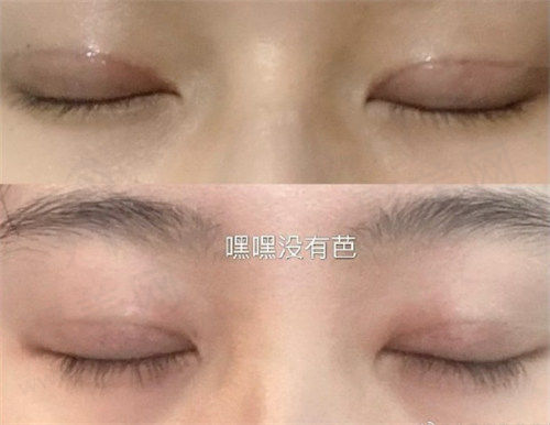外地患者如何预约吕中方医生的号？