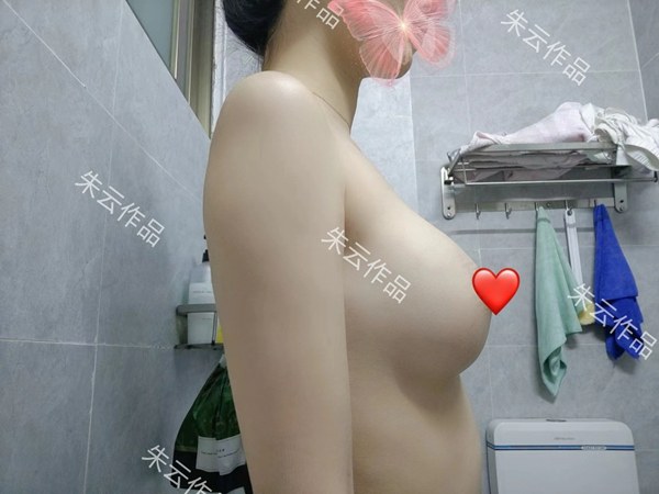 广州朱云隆胸医生简介：