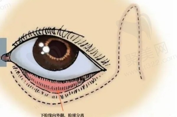 大连双眼皮修复好的医生名单