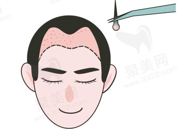 广州倍生和雍禾哪个好？价格体系与性价比评估