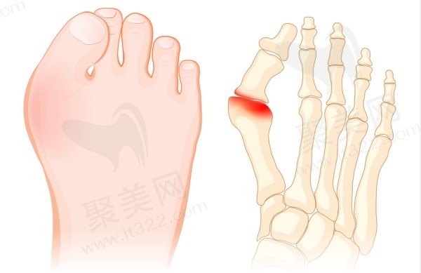 苏敬达和马桂文谁做大脚骨好