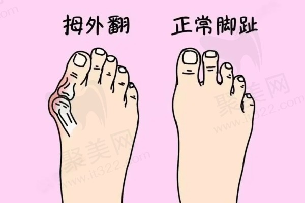 苏敬达和马桂文谁做大脚骨好