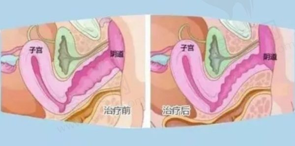 苏州打紧缩针医院排名榜单