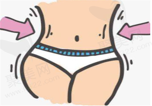 刘中 国医生吸脂手术优势