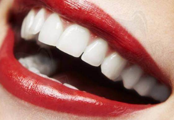 合肥美奥：牙齿美白优势
