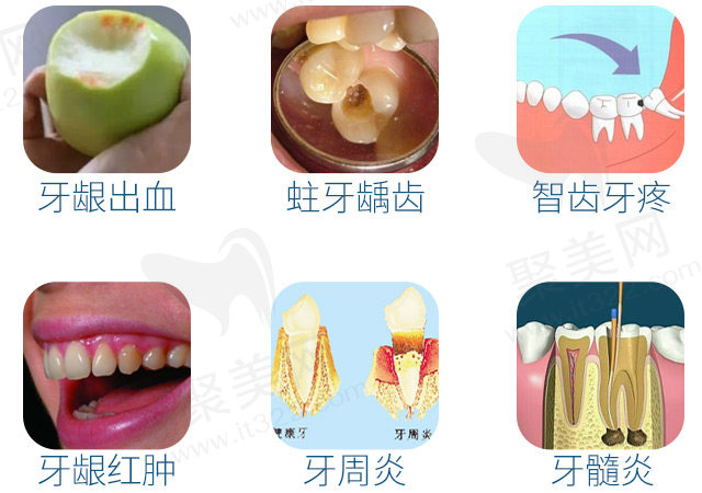 上海洗牙价格,上海地区哪里洗牙比较靠谱