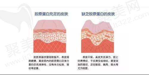 青岛壹美天成翟朝晖医生眼部整形怎么样？