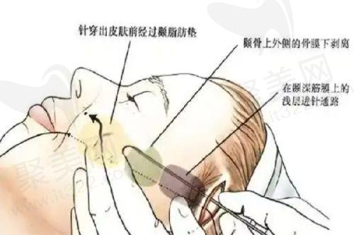 青岛壹美天成孙淼医生的真实的患者评价如下：
