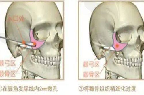 玉溪源觅医疗美容诊所的术后关怀