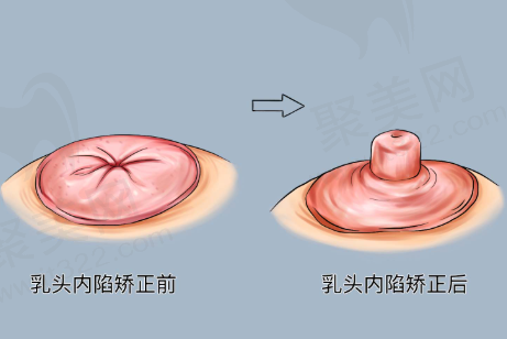 总结：选择玉溪源觅医疗美容诊所